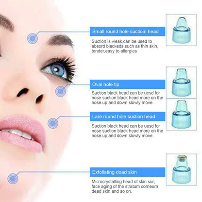 Cell Operated Blackhead Removal Machine Derma Suction 4 in 1