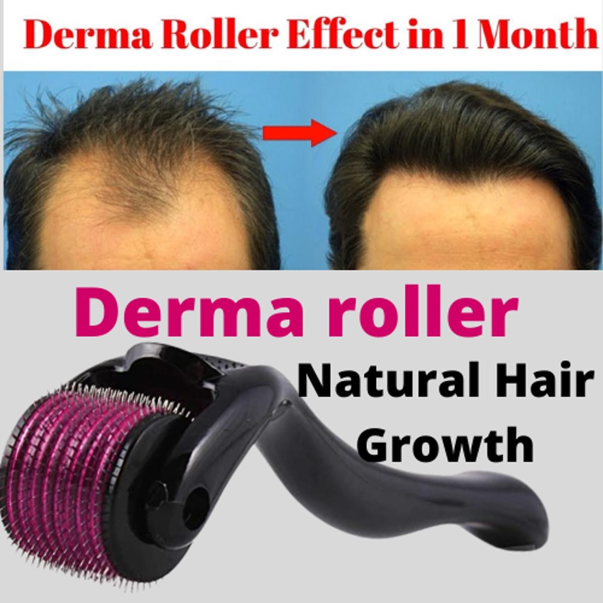 Derma Roller Hair Therapy Micro-needle For Male And Female