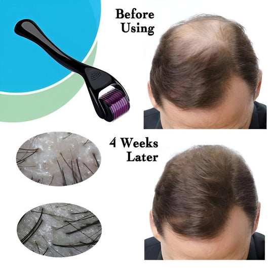 Derma Roller Hair Therapy Micro-needle For Male And Female